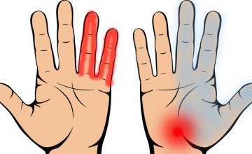 7 komoly betegség, amire a kézfejed figyelmeztet