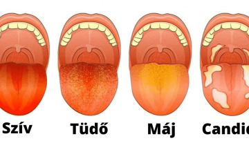 Nyújtsd ki a nyelved - fontos információkat ad az egészségedről