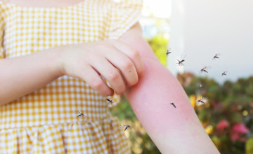 Természetes megoldás a nyári bőrirritációkra – amit a csípésekről és a bőröd védekezéséről tudni érdemes