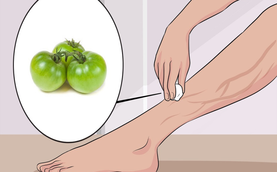 A zöld paradicsom a leghatékonyabb a seprűvénák ellen