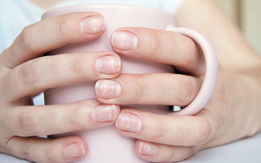 Fehér foltok a körmön – árulkodó jelek vagy ártalmatlan sérülések nyomai