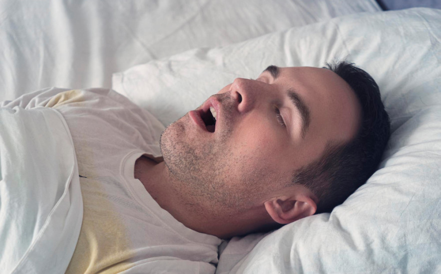 Miért ébredek kiszáradt szájjal? Az éjszakai szájlégzés veszélyei