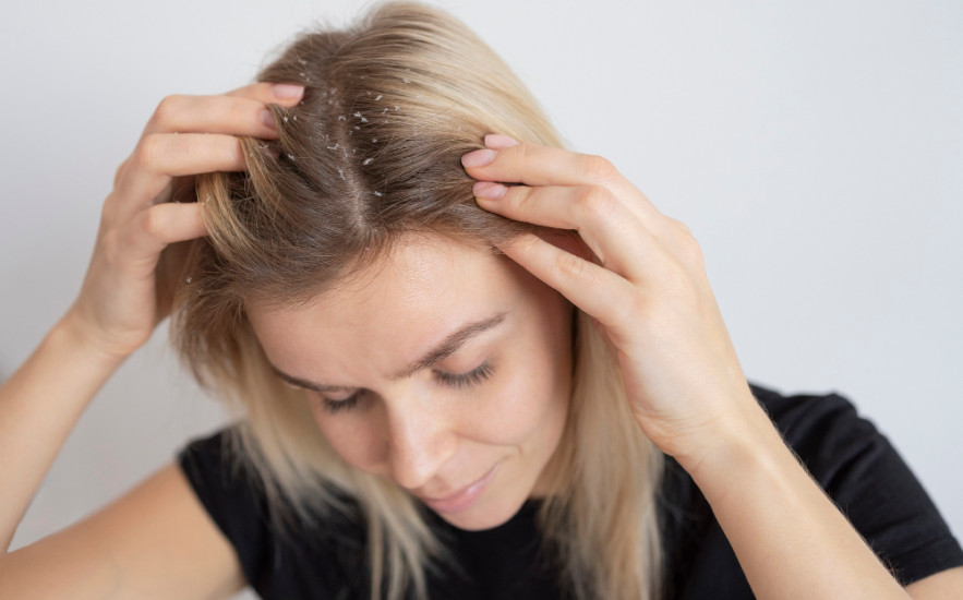 Hullik, töredezik, korpásodik? Nézd meg, milyen mikrotápanyag hiánya áll hajproblémák mögött!